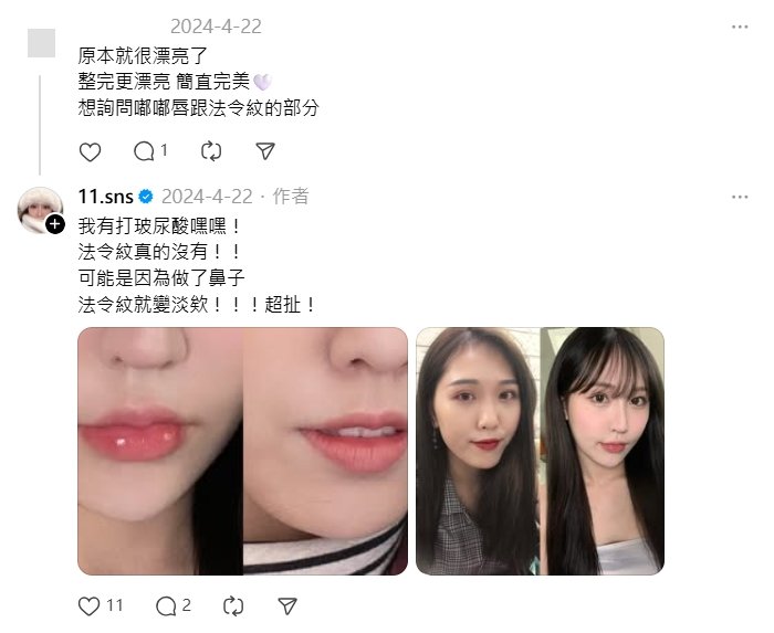 Joeman新女友網紅「整形前後對比照」流出…她直言:整個判若兩人!