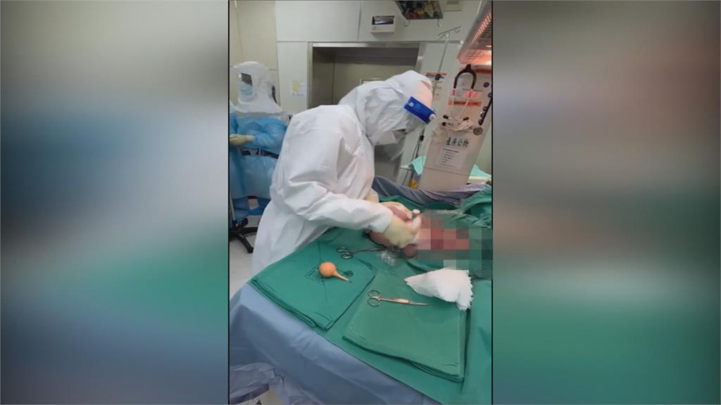 產婦染疫 醫護團隊全副武裝剖腹迎接新生命