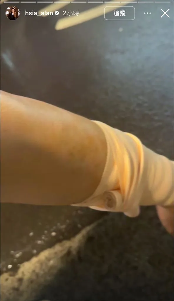 快新聞／遭埋伏砍殺！「夜店大亨」夏天倫濺血　深夜吐心聲：為朋友擋一刀