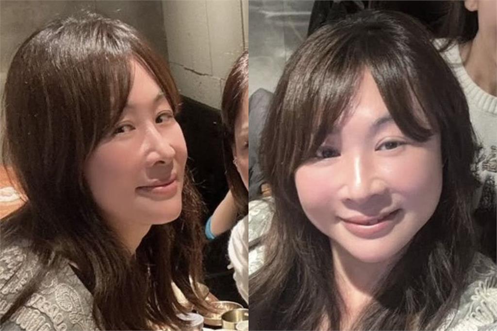 連戰50歲媳婦路永佳飛韓國「進廠維修」！親曬驚人成果喊：好漂亮