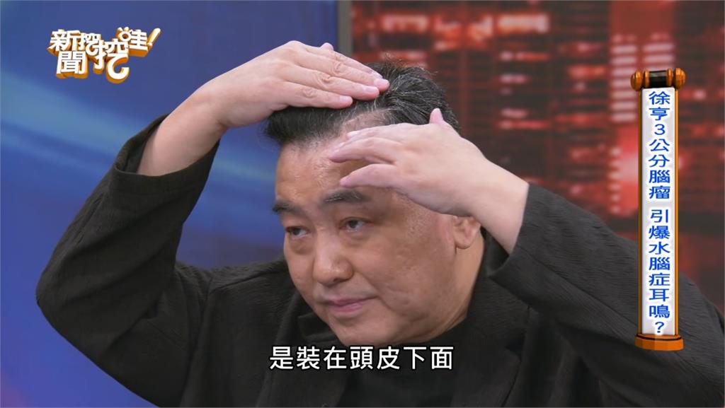 59歲徐亨長3cm腦瘤靠「1裝置維生」掀開嚇壞全場！親揭「不去中國發展」真相