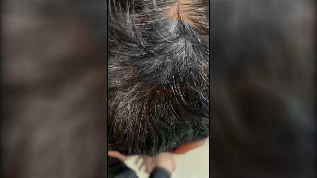 逛賣場突昏倒撞到頭破血流 男星高群:差點就「登出」了