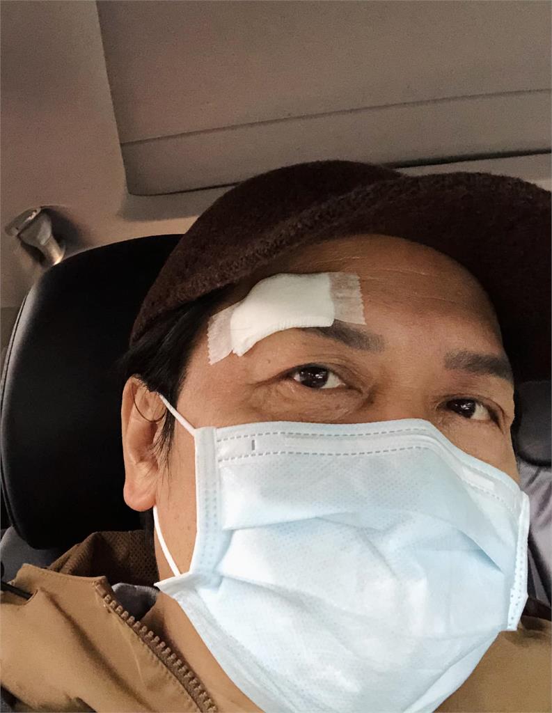 57歲許傑輝怎麼了?傳入院治療「破相照」曝光 驚爆4原因網瘋猜