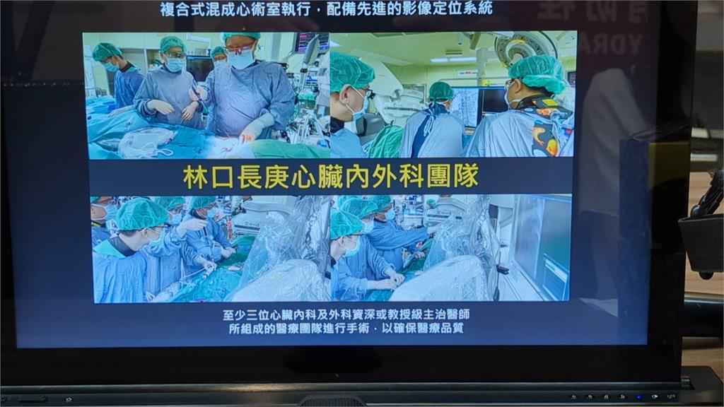 經導管主動脈瓣置換手術 換瓣膜輕微麻醉免開胸