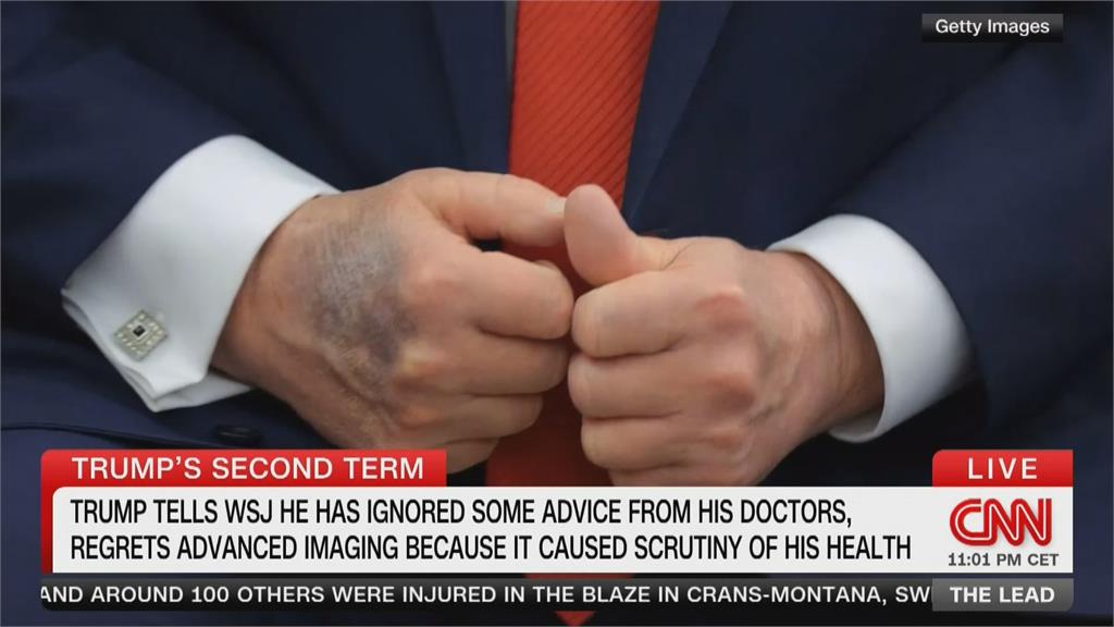 病了?川普「頸部大片紅腫」 健康狀況引關注