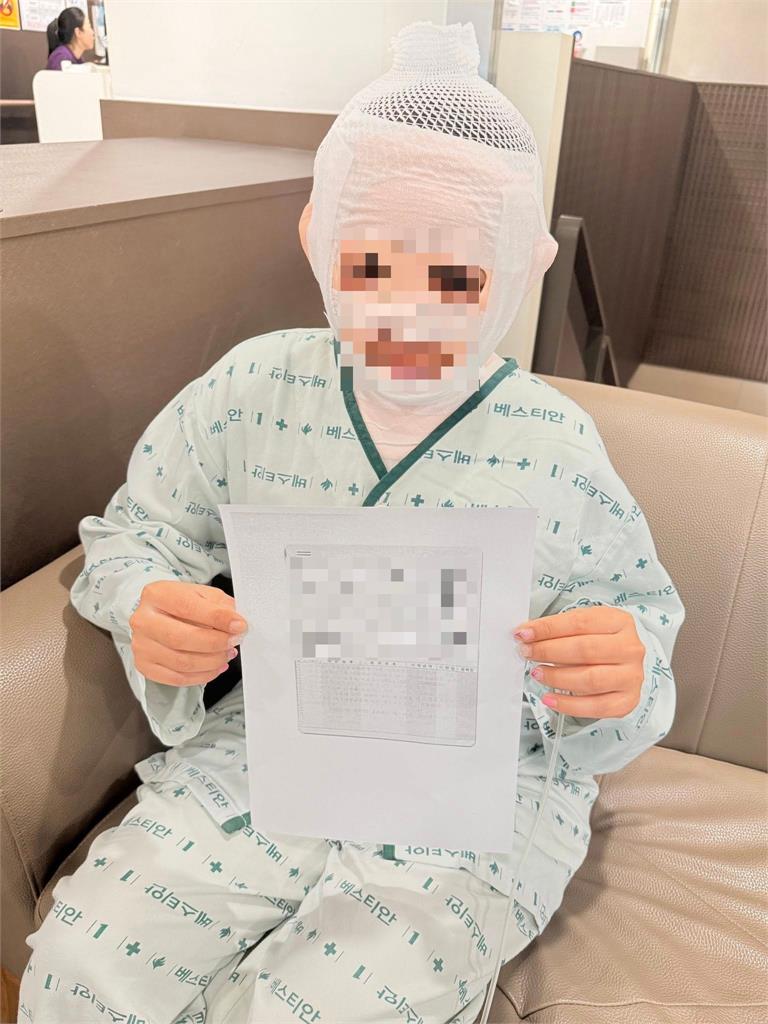 男子怕被戴綠帽趁妻熟睡「拿煮沸熱水倒臉」!老婆毀容PO網求救驚人傷勢曝