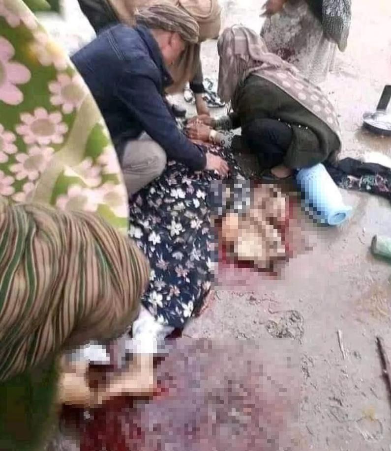 打臉「不迫害女權」承諾！婦女「未穿罩袍」當家人面遭塔利班射殺